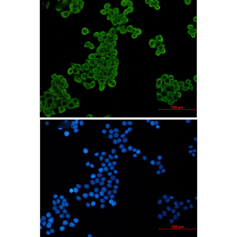 Elongation factor 2 Rabbit mAb